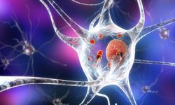 Çinli bilim insanları Parkinson hastalığının altında yatan patolojik beyin ağını belirledi