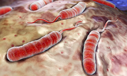 Filipinler'de bu yıl 67 kişi koleradan yaşamını yitirirken vaka sayısı yüzde 282 arttı