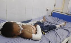 BM: Afganistan patlamamış mühimmat kaynaklı can kayıplarında dünyada üçüncü sırada yer alıyor