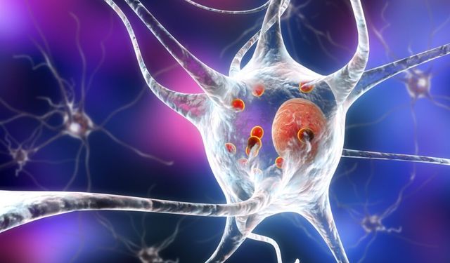 Çinli bilim insanları Parkinson hastalığının altında yatan patolojik beyin ağını belirledi