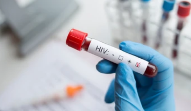 Avrupa Bölgesi'nde çok sayıda teşhis edilmemiş HIV vakası var