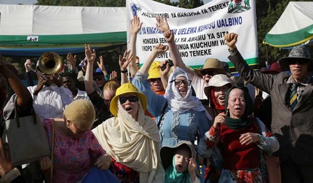 Tanzanya'da Uluslararası Albinizm Farkındalık Günü etkinliği düzenlendi